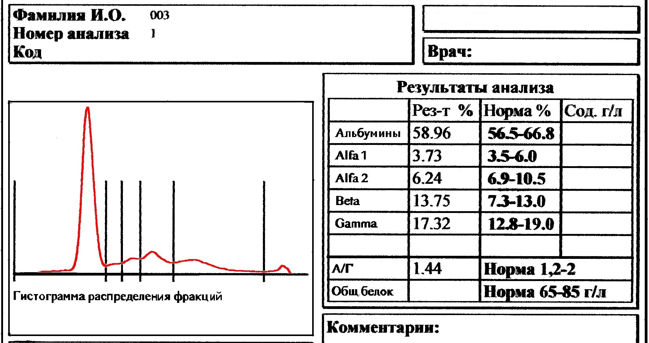 Анализ градиент. Электрофорез белковых фракций крови расшифровка норма. Электрофорез белков нормы фракций. Электрофорез белков сыворотки крови норма. Электрофорез белков сыворотки крови расшифровка.