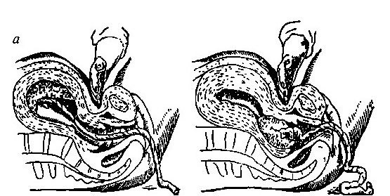 Массаж матки. Признак отделения последа Кюстнера-Чукалова. Признак Кюстнера Чукалова. Метод Чукалова Кюстнера. Кюстнера Чукалова признак отделения.